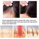 thumbnail image 4 of Spray para el cuidado de las raíces del cabello con esencia denso para el cabello con jengibre, líquido reparador y de crecimiento fuerte | 8221208081628, 4 of 4