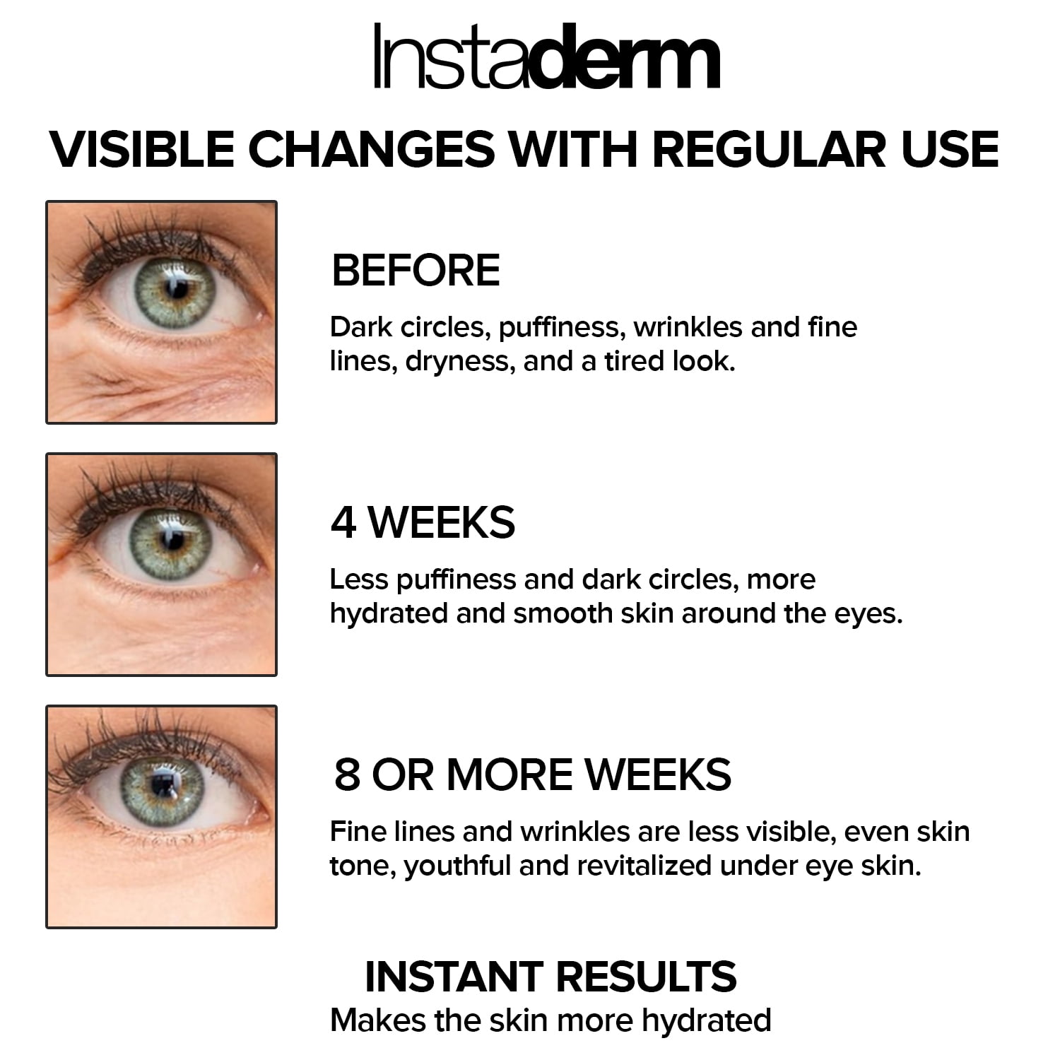 Eye Repair Cream–Reduces the Appearance of Dark Circles, Puffiness, Under Eye Bags, Fine Lines & Wrinkle, Anti-Aging Formula with Niacinamide Visibly Smooth, Brighten, & Hydrate Skin.