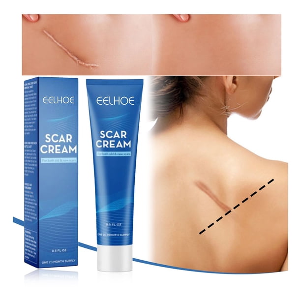 Skin Repair Ointment Desalination Scar Ointment Scald Burn Mark Repair