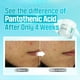 thumbnail image 3 of Crema Numbuzin No.1 Pantoténico B5 Active Calmante 80 ml, 3 of 9