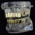 thumbnail image 5 of 18K Gold Plated Hip Hop Removeable Mouth Grillz Set Removeable Fake Teeth Set Top and Bottom Dentur Teeth Flat Fake Teeth Set, 5 of 7