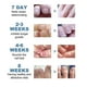 thumbnail image 3 of Pegatinas correctoras para uñas Parches correctores para uñas encarnadas Tratamiento para paroniquia Recuperación Alivio de la involución de las uñas Cuidado de los pies, 3 of 4