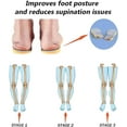 thumbnail image 3 of Supination Insoles For Over Supination High Arch Support,orthotic Inserts For Foot Alignment, Knock Knee Pain, Bow Legs, O/x Type Leg, 3 of 5
