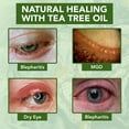 thumbnail image 4 of Crema de ojos NOVEHA con aceite de árbol de té antiarrugas, 50 ml, 4 of 7