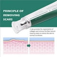 Scar Removal Cream Acne Spot Treatment Gel Skin Care Cream Safe for