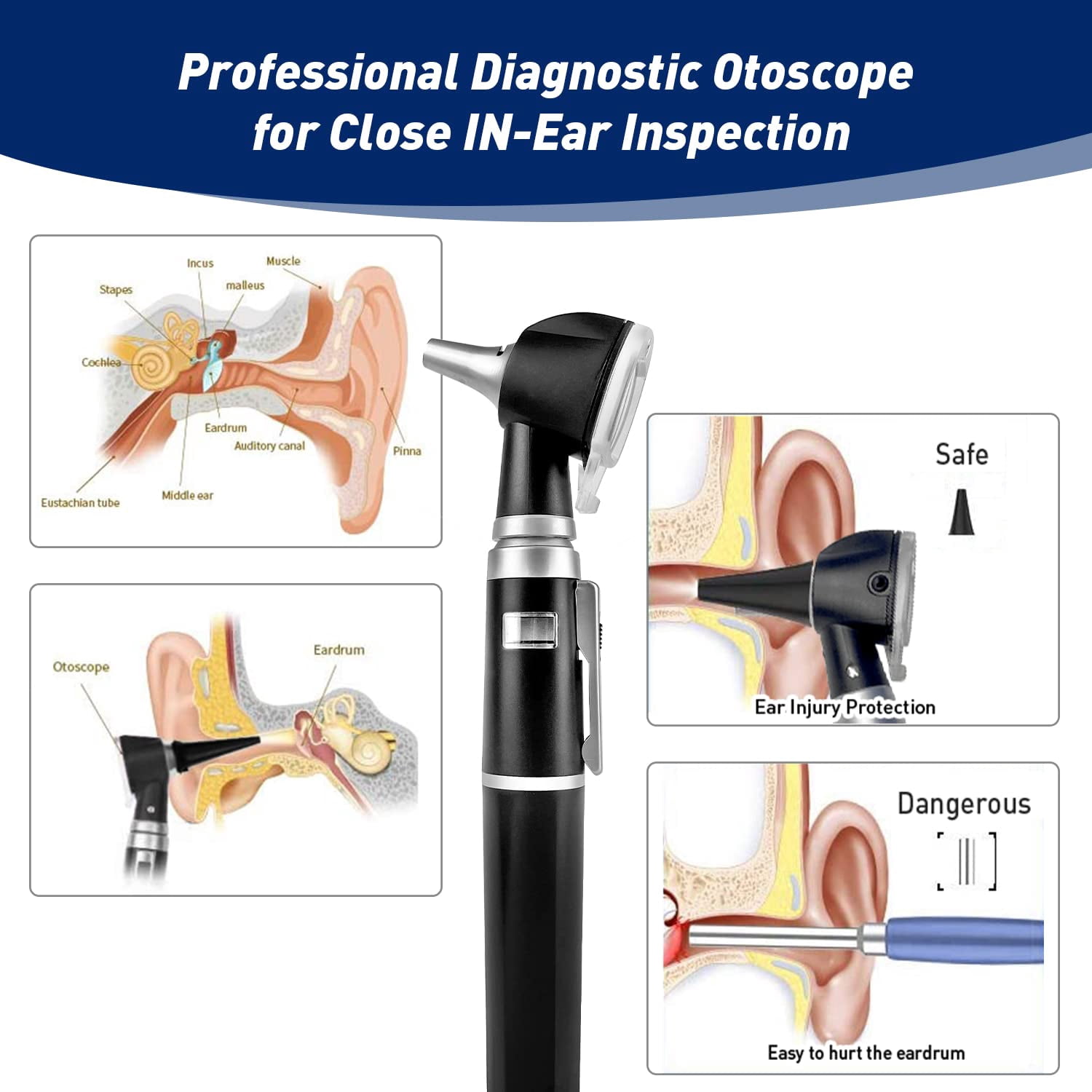 SCIAN 2nd Generation Ear Scope Otoscope with Light, Diagnostic Ear Care Tool with LCD Screen - Pocket Medical Otoscope Set for Nurse, Children, Adults, Pets(Black)