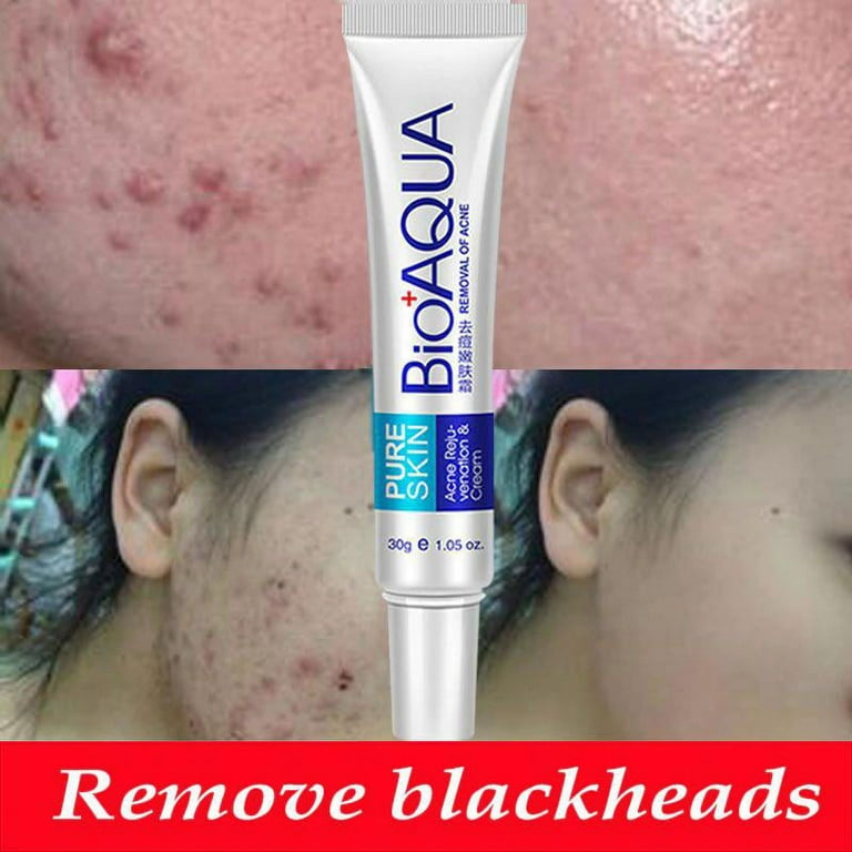 Bioaqua 2024 acne cream