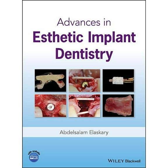 Advances in Esthetic Implant Dentistry (Hardcover)