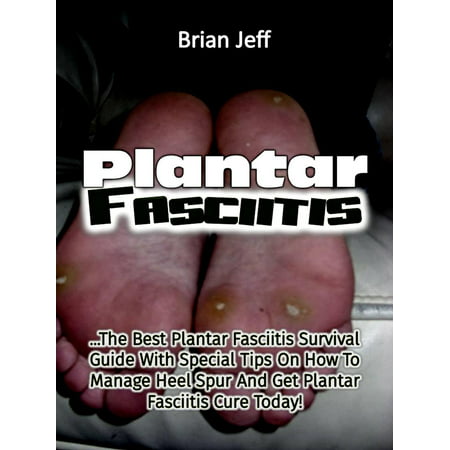 Plantar Fasciitis: The Best Plantar Fasciitis Survival Guide With Special Tips On How To Manage Heel Spur And Get Plantar Fasciitis Cure Today! - (Best Home Remedy For Plantar Fasciitis)