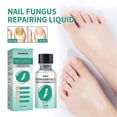 thumbnail image 2 of New Kerassentials For Toenail Fungus, Kerassentials Toenail Fungus Treatment Oil, 2 of 4