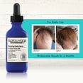 thumbnail image 2 of Eprouvage Reviving Scalp Serum 2 oz, 2 of 3