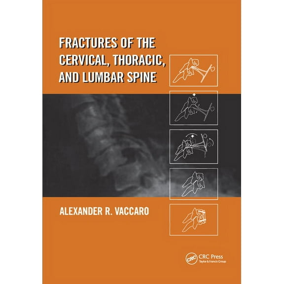 Fractures of the Cervical, Thoracic, and Lumbar Spine, (Paperback)