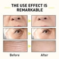 thumbnail image 2 of Vaporisateur Anti-Rides au Collagène Raffermissant et Éclaircissant pour Soin de la Peau du Visage, 2 of 5