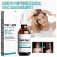 thumbnail image 4 of Suero Para Fortalecer La Raíz Del Cabello, Reduce La Sequedad Suero Para El Crecimiento Del Cabello Activa Los Folículos 2 Piezas 60 Ml Para Todo Tipo De Cabello, 4 of 7
