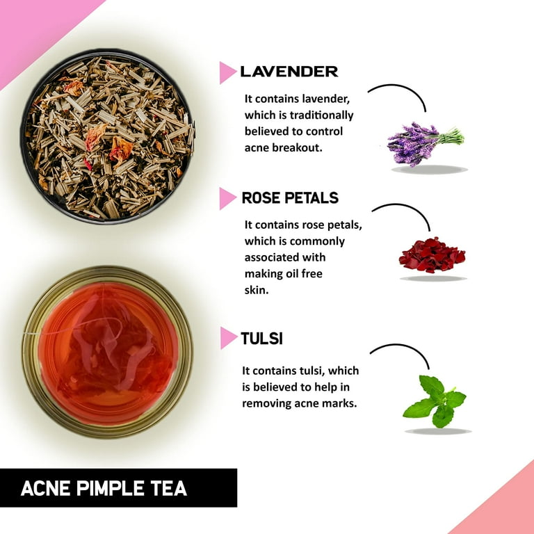 Tea for acne deals
