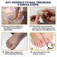 thumbnail image 3 of Toenail Repair Pads, Multi-Purpose Fungal Nail Treatment for Damaged & Discolored Nails, 1/2/3PCS, 3 of 5
