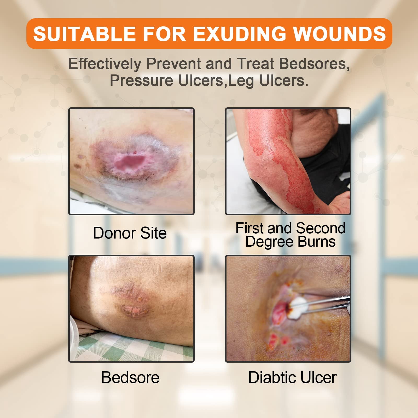 Carbou Wound Dressing Sacrum Silicone Foam Dressing with Adhesive Border, 6''x7'' Waterproof Sacral Pad for Sacrum,Butt Bed Sore,Pressure Ulcer,High Absorbent Wound Care Bandages,5 Pack