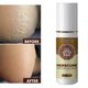 thumbnail image 2 of 3x Foot Spray Anti-fungal Infection Beriberi Spray Damaged Skin Moisturizer, 2 of 5