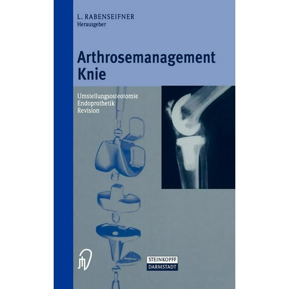 Arthrosemanagement Knie: Umstellungsosteotomie -- Endoprothetik -- Revision, (Hardcover)