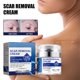 thumbnail image 1 of Scar Removal Cream Scar Repair Cream Scar Removal And Skin Repair 50ml, 1 of 9