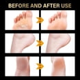 thumbnail image 4 of Botines exfoliantes HUOGUO con aroma a lavanda para talones agrietados, 4 of 5