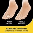 thumbnail image 3 of Vendajes de hidrogel eliminadores de verrugas Dr. Scholl's Clear Away, 3 of 9