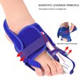 thumbnail image 3 of Separador de dedos para hombres y mujeres correas ajustables alisadores juanetes para el cuidado de los pies, 3 of 6