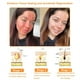 thumbnail image 3 of Tratamiento integral para la piel Cream Flysmus Bee Venom de 50 ml, 3 of 7
