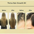 thumbnail image 2 of Aceite natural para el crecimiento del cabello con cafeína, aceite de ricino, aceite de argán, aceite de coco y aceite de romero para engrosar el cabello., 2 of 2