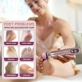 thumbnail image 4 of Electric Callus Remover for Feet, Foot Scrubber Pedicure Tool with 16 Speeds, Dual Rotation & Dual Charging, 4 of 6