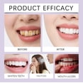 thumbnail image 4 of Whitening Stain Remover Toothpaste for Smile, Enamel Brightening Paste, Anti-Plaque Oral Care – 75g, 4 of 7