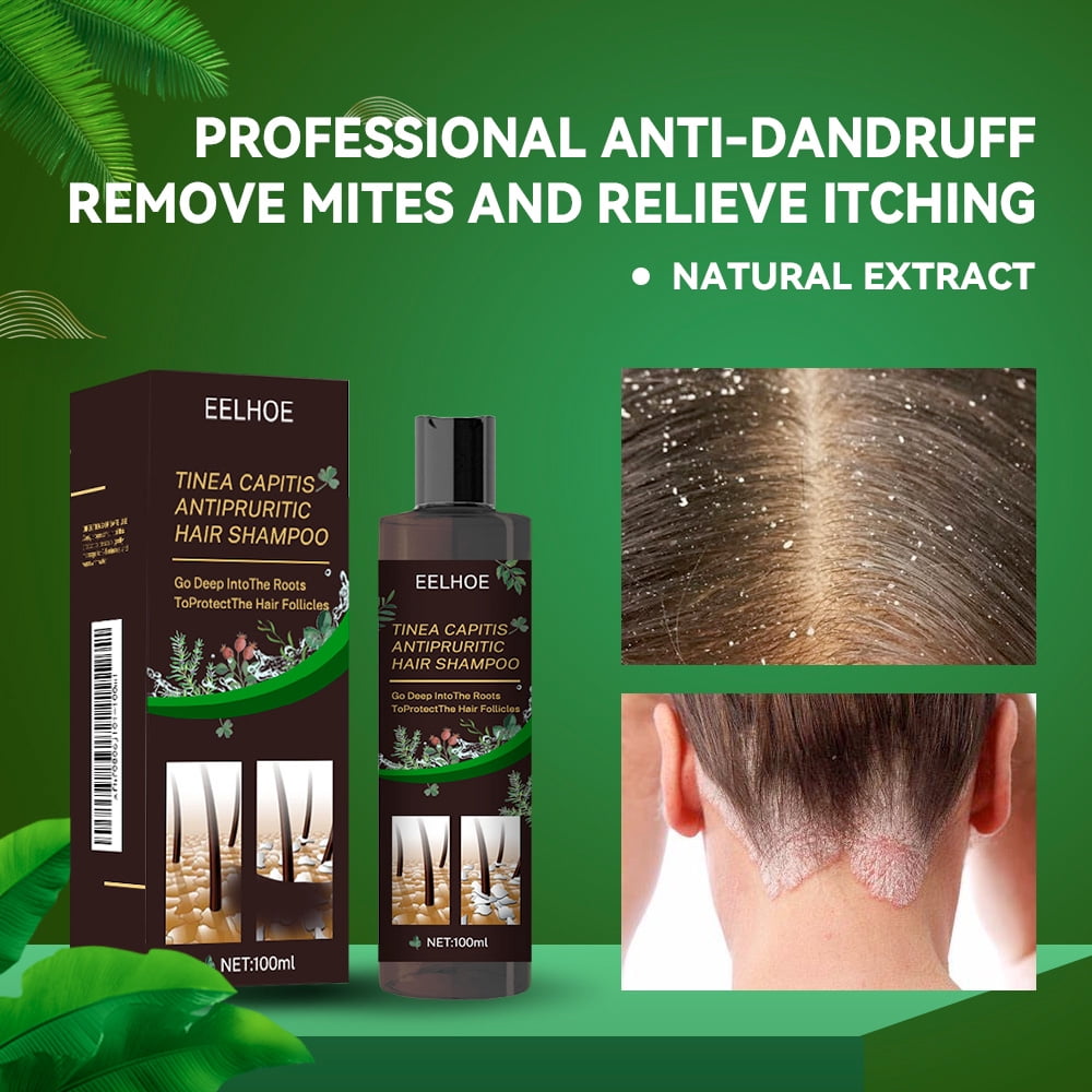 Ringshlar Hair Shampoo for Tinea Capitis Antipuritic Professional Antidandruff Remove Mites and Relieve Itching Shampoo 10.14 Oz