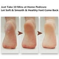 thumbnail image 4 of Kripyery Dead Skin Callus Remover Dry Wet Dual Use Foot File Rasp Pedicure Care Scrubber, 4 of 8
