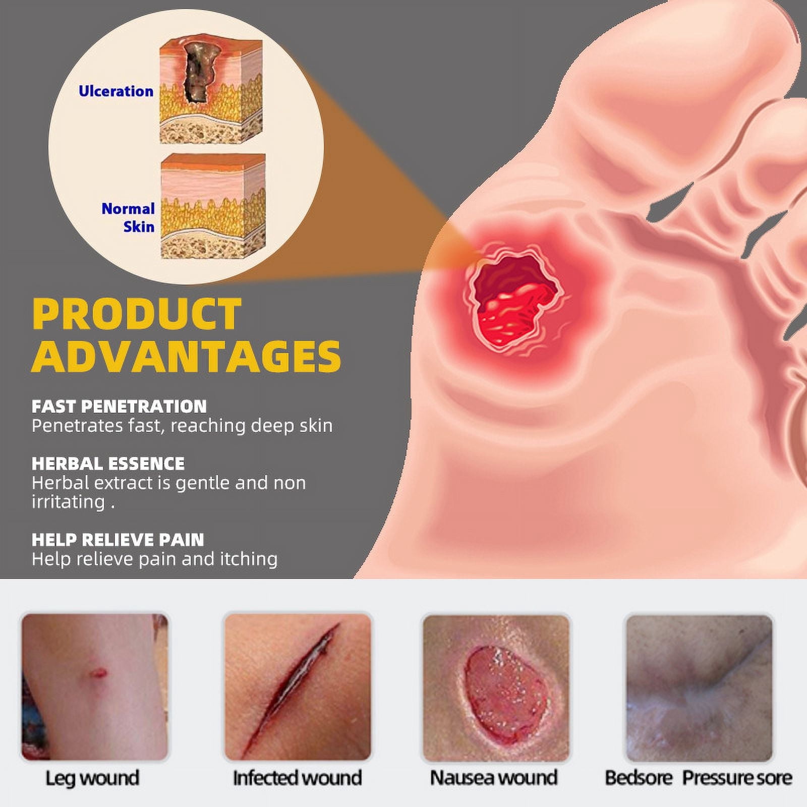 Bedsore Cream Moisturize Decubitus,Ulcer Cream,Rapid absorption,quick-acting,Remove Rots Myogenic Pressure Ulcer Cream Wound Healing Body Care.Wound Healing Cream for Skin Care,3pcs