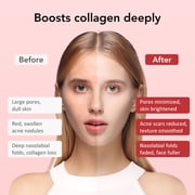 Facial Massager Beauty Device, Electric Face Lifting, Skin Rejuvenation, 7 in 1 Skin Care Tool with 3 LED Light, 3 Vibration & Massage for Anti-Aging, Deep Cleansing, Skin Tightening, Skin Refreshing
