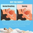 thumbnail image 6 of Anti Snoring Device Mouthpiece, Professional Comfortable&Adjustable Snore Mouthpiece,Snoring Solution for Men/Women Better Sleep, 6 of 7
