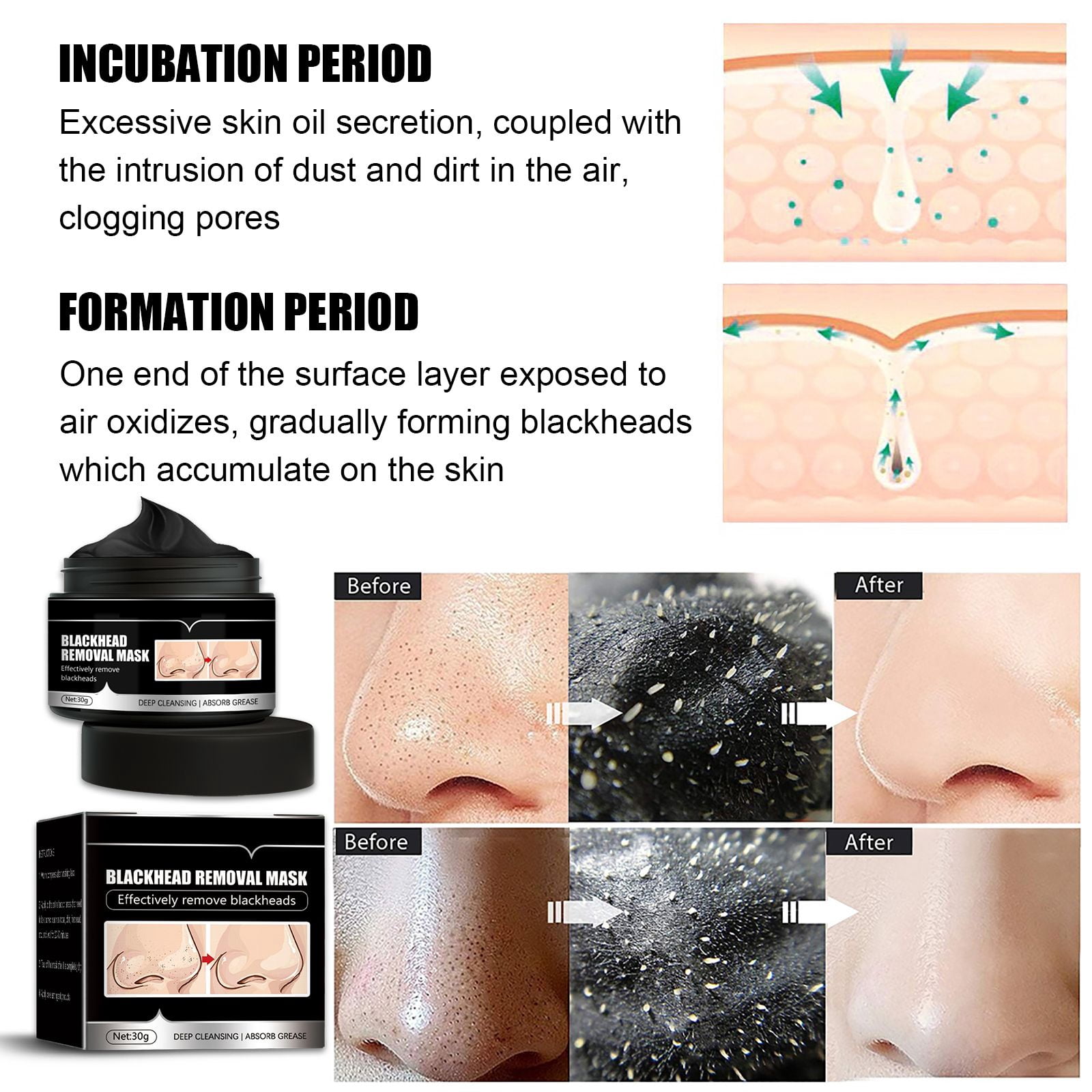 Alvantor Blackhead Remover Mask, Charcoal Peel off, Pore Minimizer, 1.05oz