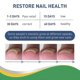 thumbnail image 4 of Jaysuing Toe Nail Groove Correction Stickers Nail Repair Toe Ingrown Nail Correction Soft Nail Gray Nail Repairing Mask - 50Pcs, 4 of 5