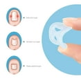thumbnail image 3 of Ingrown Toenail Correct Brace, Toenail Corrector  Stretch  10 Pcs  for Foot Care, 3 of 8