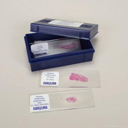 Human Lung Pathology Microscope Slide Set price history on PriceWatchPro