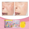 thumbnail image 4 of Fiudx Almohadillas de Ácido Kójico, Esponjas Exfoliantes Limpiadoras de Cúrcuma, Tratamiento Facial Iluminador Natural, Reducción de Manchas Oscuras E Hidratación, Rutina Diaria de Cuidado de La Piel, 4 of 6
