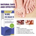 thumbnail image 3 of Fungal Nail Treatment - 30ml Extra Strong Nail Fungus Treatment for Toenail - Anti Fungus Nail Repair and Strengthen, 3 of 5