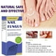 thumbnail image 3 of Fungal Nail Treatment - 30ml Extra Strong Nail Fungus Treatment for Toenail - Anti Fungus Nail Repair and Strengthen, 3 of 5