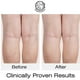 thumbnail image 5 of Cream Beauty Facial Extreme Vitamina K Hidratante, 5 of 8