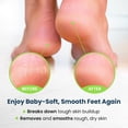 thumbnail image 6 of FootCure Toenail Fungus Treatment Extra Strength - Tea Tree Antifungal Balm & Foot Soak for Toenail Softener, Yellow Toenail Treatment, Ingrown Nail, 6 of 9