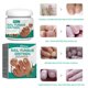 thumbnail image 3 of Gel para eliminar hongos en las uñas crema antiinfecciones para tratamientos de uñas pomada reparadora de 20g, 3 of 9