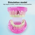 thumbnail image 5 of Sylvtty Dental Implant Model Teaching Aid for Dentist Student School Removable Teeth Orthodontic Demo Models Dental Prosthetic Demonstration, 5 of 6
