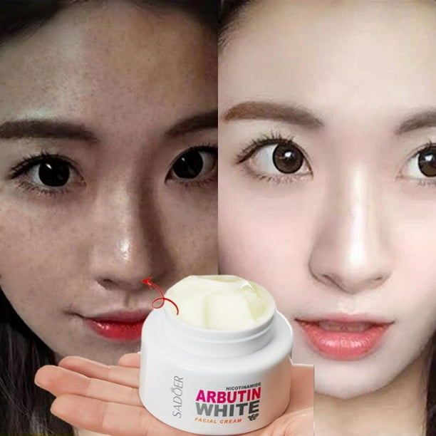 Crema blanqueadora de nicotinamida arbutina, productos coreanos para el cuidado de la piel, blanqueamiento, manchas oscuras Fivean unisex