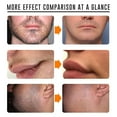 thumbnail image 2 of Men's Facial Hair Removal Cream for Beard Chin Hairline Underarm Chest Back Legs Arms, Depilatory Cream, Prevent Hair Growth, 2 of 6