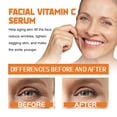 thumbnail image 3 of Sero de Vitamina C Facial, Vitamina C Que Acumula la Piel Hidratante en el Envejecimiento anti -ANVEJECIMIENTO REDUCCIÓN LAS LINAS FINAS PARA EL HOGAR, 3 of 7
